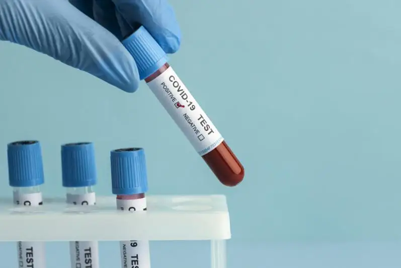 Коронавирус: Дельта штамми ҳақида нималарни билишимиз керак