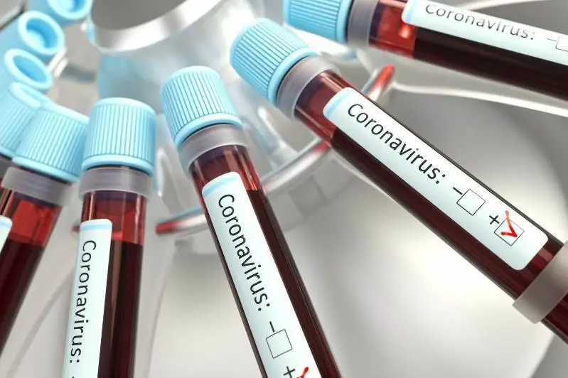 Ўзбекистонда коронавирус юқтириш ҳоллари сони кескин ошмоқда