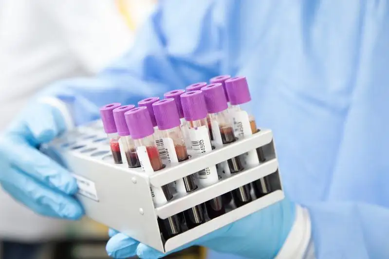 Киевда рекорд даражада коронавирус юқтириш ҳолатлари қайд этилди