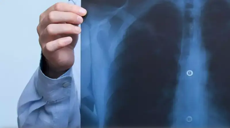 رەنتگەنگە جىلىنا قانشا رەت تۇسكەن دۇرىس؟