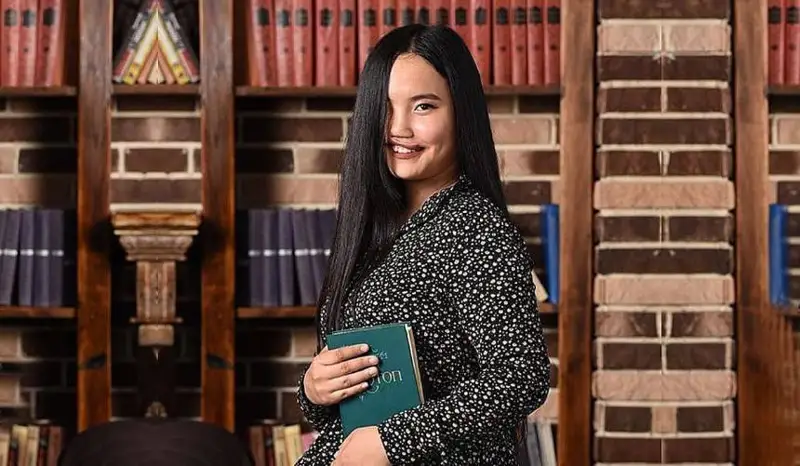 «بالالار ۇرەيلەنە قارايدى»: جارتى بەتى كۇيگەن قىز الەۋمەتتىك جەلىنىڭ جۇلدىزىنا اينالدى