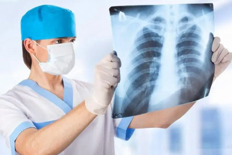 قىتايدا پنيەۆمونيادان ادامنىڭ قايتىس بولۋ جاعدايى تىركەلدى