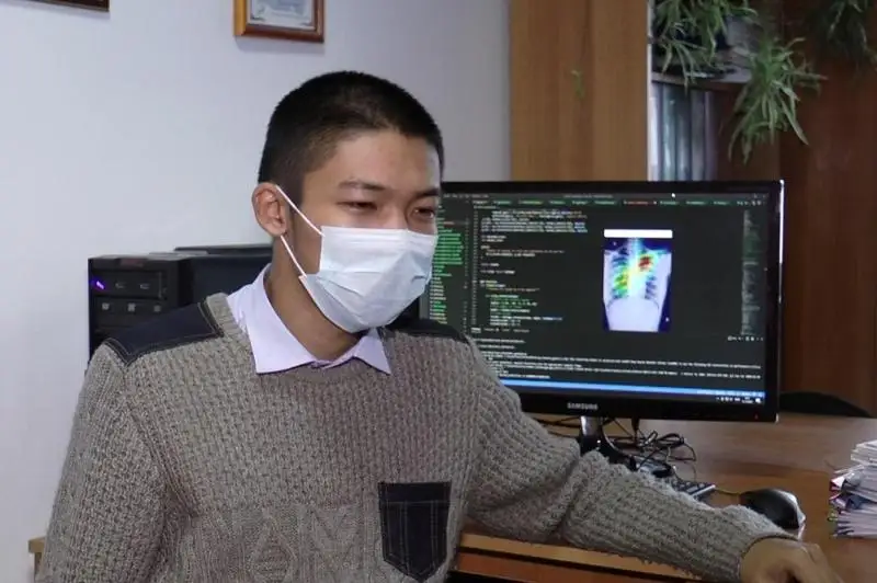 Облегчающую расшифровку рентгена легких программу разработал карагандинский студент