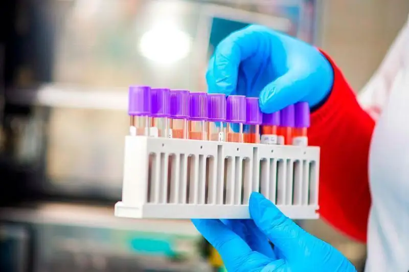 الماتى وبلىسىندا 400 ادامنان كوروناۆيرۋس انىقتالدى