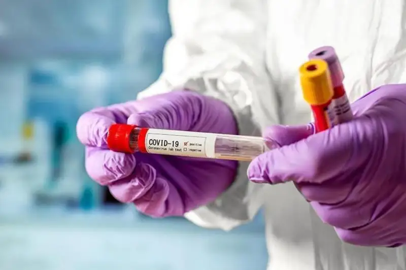 Германия предупреждает о росте числа случаев заболевания COVID-19 осенью