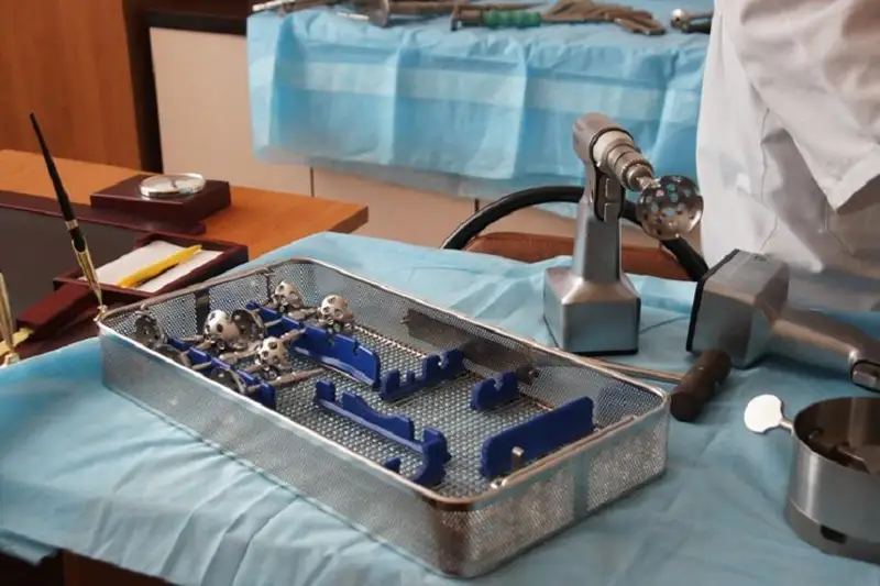 Собственный банк костной ткани есть в Караганде