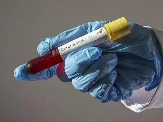 وڭتۇستىك سۋداندا كوروناۆيرۋستى جۇقتىرعان العاشقى ادام تىركەلدى