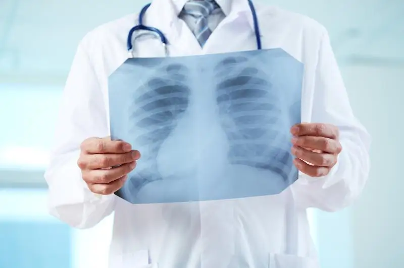 سوزىلمالى وكپە اۋرۋىنان كوز جۇماتىندار سانى 30 پايىزعا ءوسۋى مۇمكىن