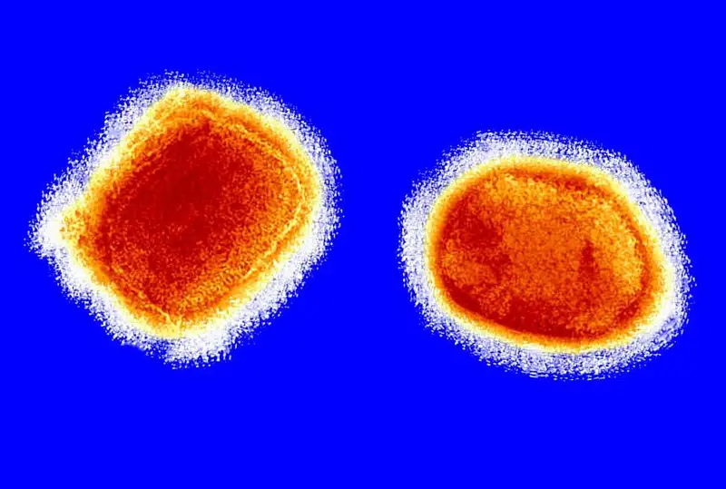 Три страны подтвердили случаи заболевания оспой обезьян