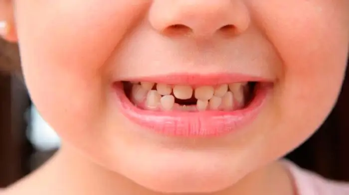 بالاڭىزعا ءتىس شىعا باستاعاندا قايتپەك كەرەك؟