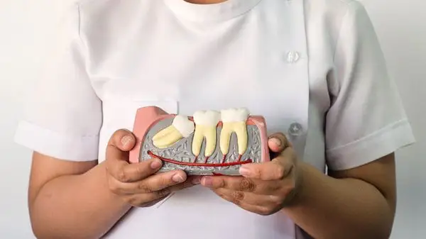 شىن مانىندە اقىل ءتىسىن جۇلۋ قاجەت پە؟