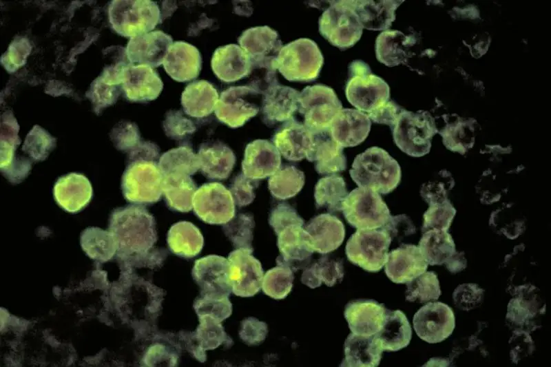 Поедающая мозг амеба обнаружена на севере США