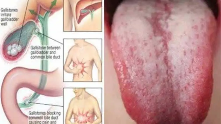ەگەر وسى 9 بەلگىنىڭ ءبىرىن بايقاساڭىز، وندا جەدەل تۇردە اعزاڭىزدى تازارتىڭىز