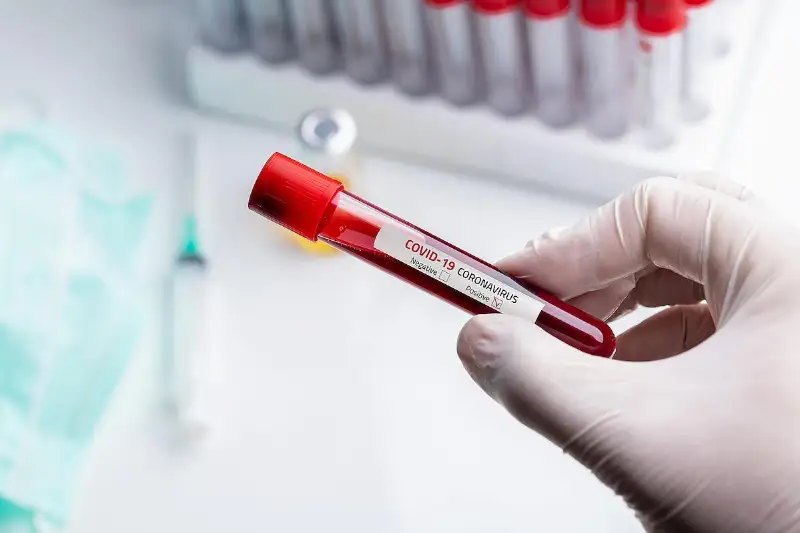 قازاقستاندا كوروناۆيرۋس جۇقتىرعان 403 ادام تىركەلدى