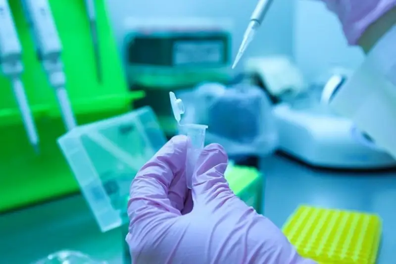 عالىمدار قاتەرلى ىسىكتى 4 جىل بۇرىن انىقتايتىن تەست جاسادى
