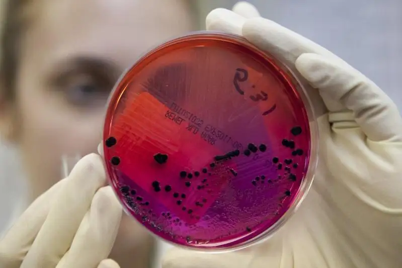 Завезенный случай сибирской язвы зарегистрировали в Акмолинской области