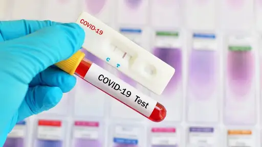 بىشكەكتە العاش رەت كوروناۆيرۋستى قايتا جۇقتىرۋ جاعدايلارى انىقتالدى