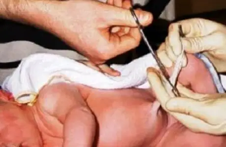 كىندىكتە دە كيە بار