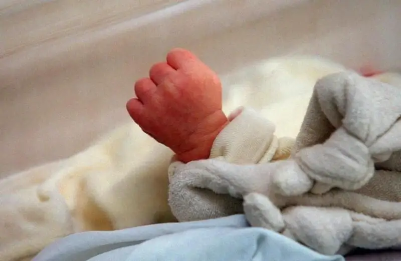 Названы основные встречающиеся пороки развития у новорожденных в РК