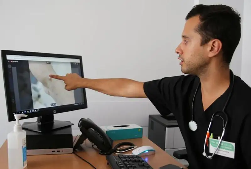 ВОЗ рекомендует провести целевую вакцинацию от оспы обезьян