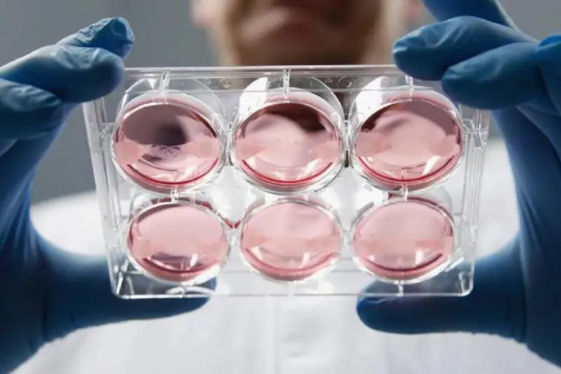 Факт сибирской язвы в одном из костанайских районов подтвердили в управлении ветеринарии