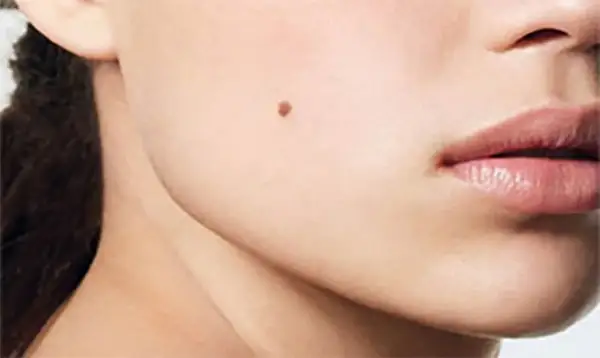 ادام دەنەسىندەگى قالدىڭ زيانى