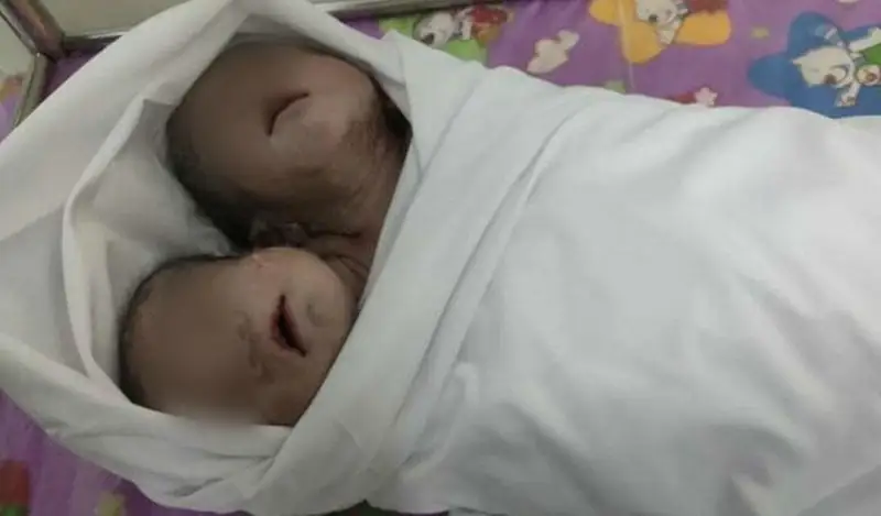 ەكى باسى بار نارەستە دۇنيەگە كەلدى