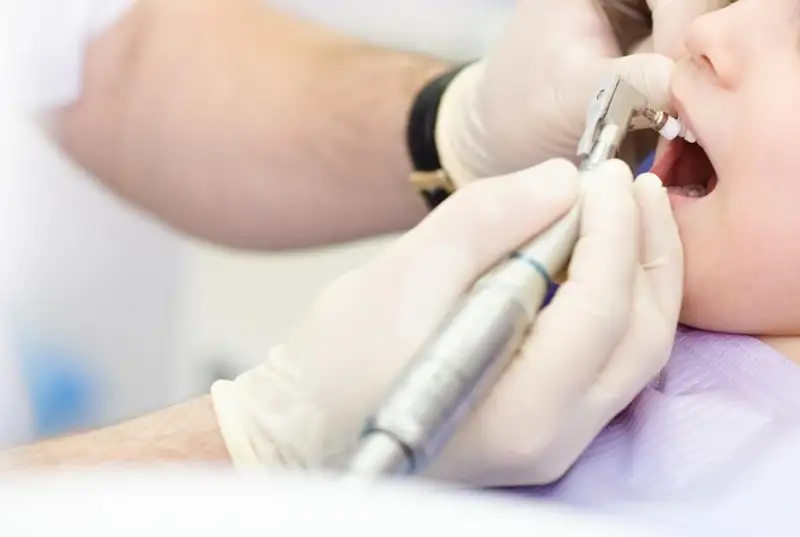 Пломбы бесплатно поставят детям в стоматологиях СКО