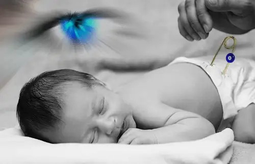 كوز تيگەن بالانى قالاي ەمدەيمىز