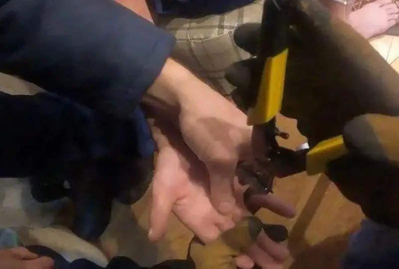 Без пальца мог остаться из-за кольца житель СКО