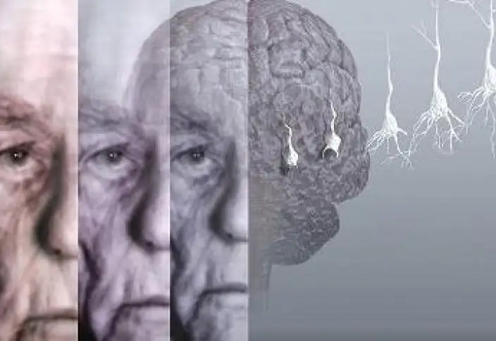 الجۋعا قاتىستى اشىق حات جازىلدى