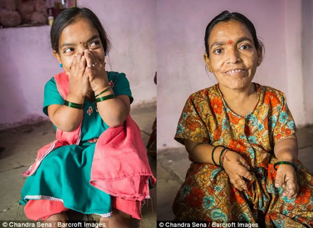 Тек ергежейлілер ғана туылатын отбасы тарихы - Фото