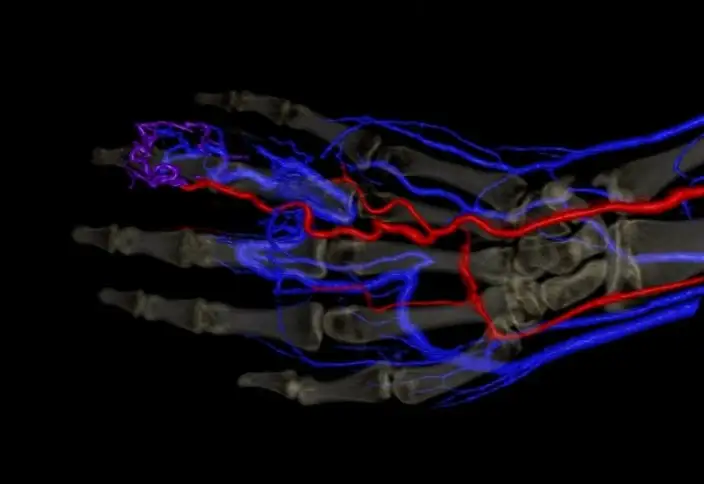 قىتاي عالىمدارى ادامدى قان تامىرلارىنا قاراپ تانيتىن جۇيە ويلاپ تاپتى