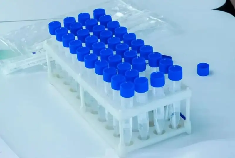 Узбекистан усилил контроль на границе из-за вспышки холеры в Афганистане