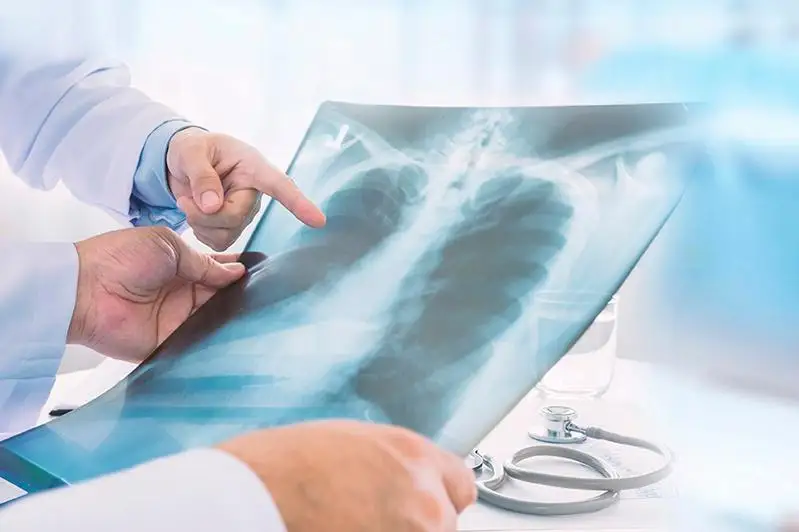 ەلىمىزدە كوروناۆيرۋس پنيەۆمونياسىنا تاعى 79 ادام شالدىقتى