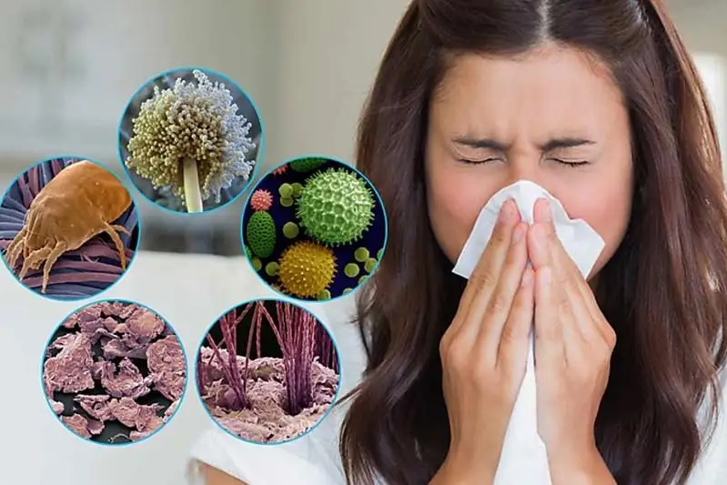 Коронавирус: аллергические заболевания не являются противопоказанием при вакцинации – эксперт