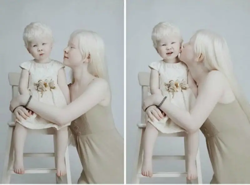 «مەنى ەلەس، كەمپىر دەپ مازاقتادى»: اقتاۋلىق اق قىزداردىڭ اناسى جۇرتتىڭ تۇسىنىسپەۋشىلىگى تۋرالى ايتتى