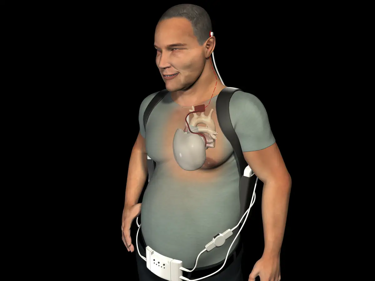 Похожее изображение