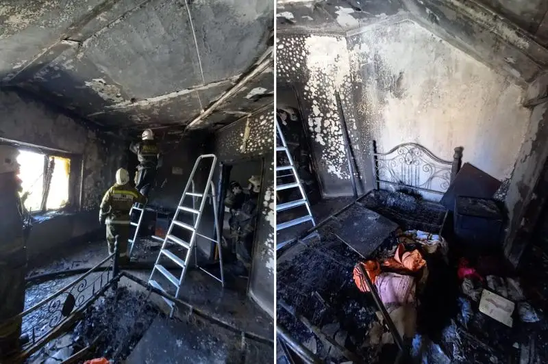 Ожоги на голове получила павлодарка из-за мобильного телефона