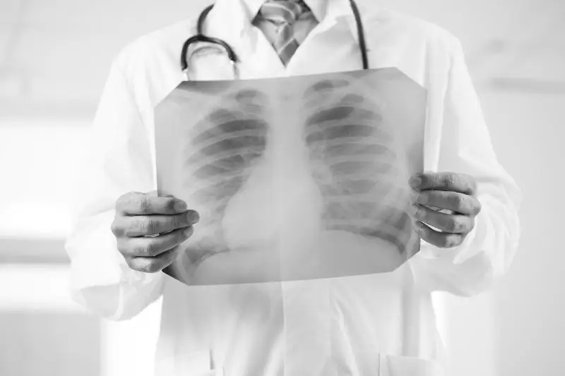 Девять человек скончались от пневмонии с признаками коронавируса  в Казахстане