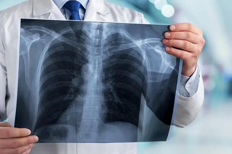 Семь человек скончались от пневмонии с признаками коронавируса