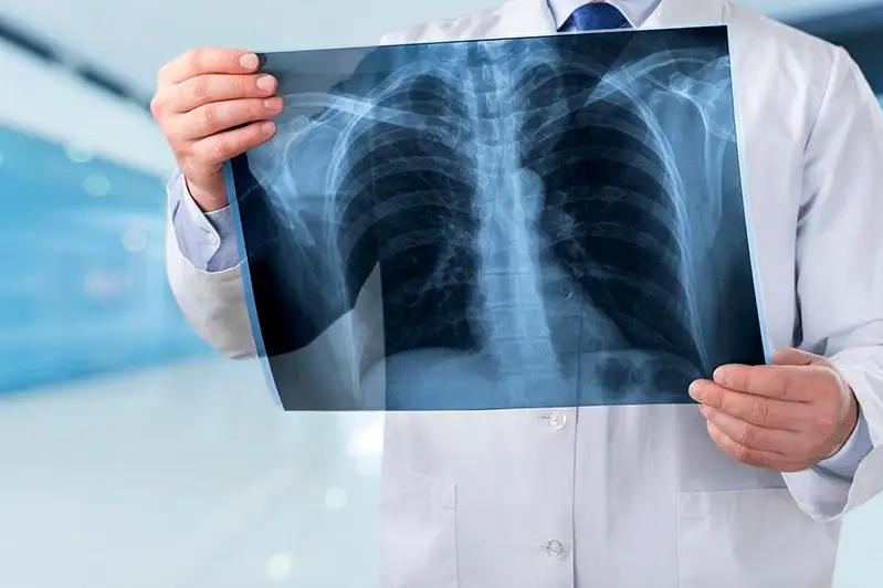 210 пациентов с раком легкого поставили на учет за год в СКО