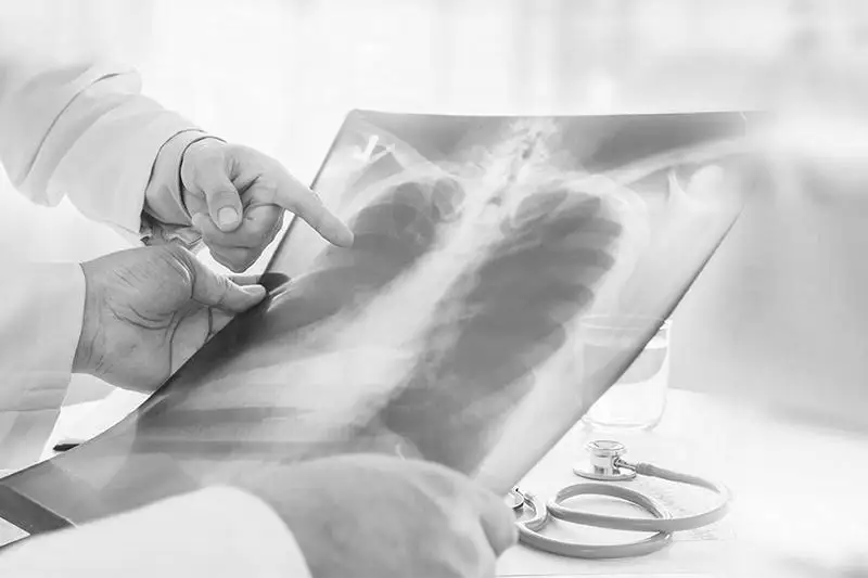 12 человек скончались от пневмонии с признаками коронавируса за сутки в Казахстане