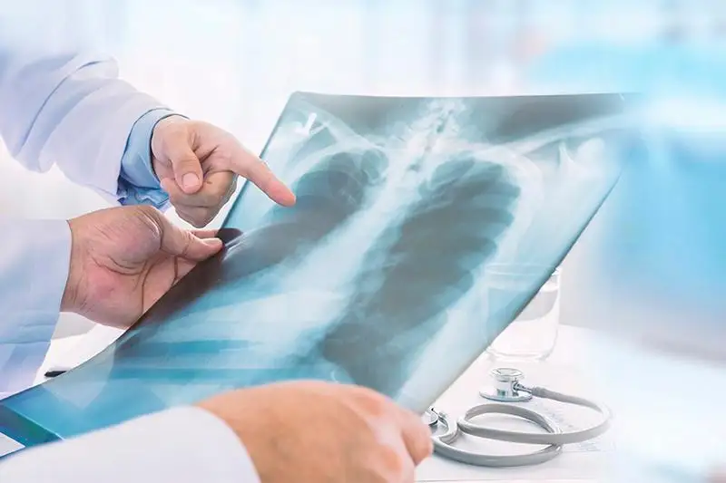 На сколько поражены легкие у вакцинированных пациентов