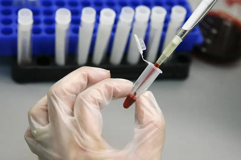 92 случая ВИЧ-инфекции зарегистрировано с начала года в Акмолинской области