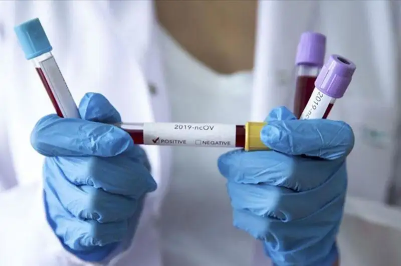 Число инфицированных COVID-19 вновь выросло в Атырауской области