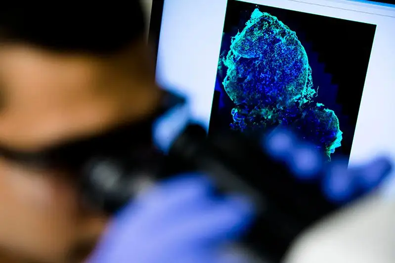 89 случаев рака на ранних стадиях выявили в Павлодарской области