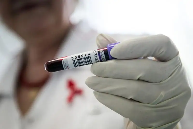 За прошлый год в Атырау выявили 47 ВИЧ-инфицированных