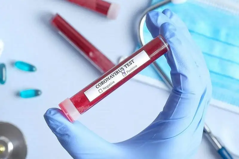 98 инфицированных COVID-19 выявили за сутки в Атырауской области