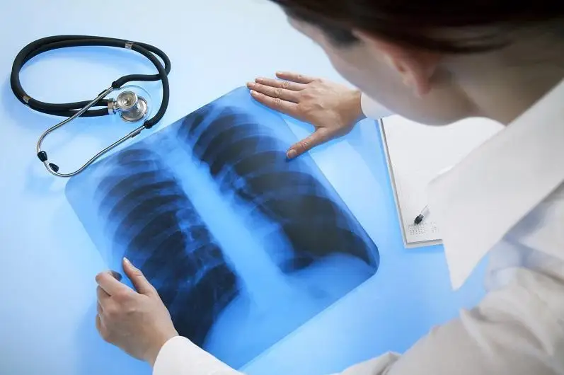 Пневмония с признаками КВИ: 151 заболевших, девять летальных случаев за сутки